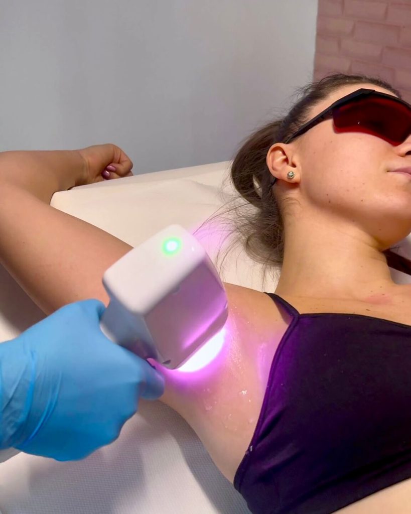 epilare-definitiva-militari-residence-10